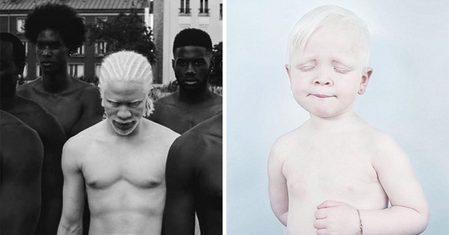 Albinolu İnsanların Fotoğrafçılar Tarafından Ortaya Çıkarılan Eşsiz Güzellikleri